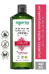 Doğal Şampuan Saç Dökülmesine Karşı Çözüm 400 Ml — görsel 1